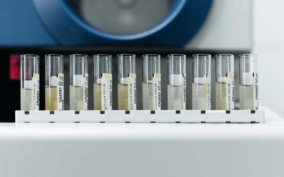 Fila de tubos con muestras rotuladas, listos para el análisis