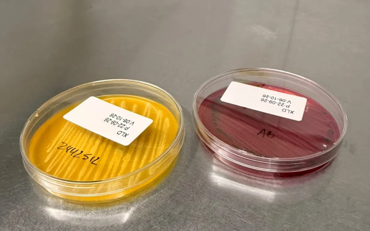 Placas de Petri con medios de cultivo para Salmonella